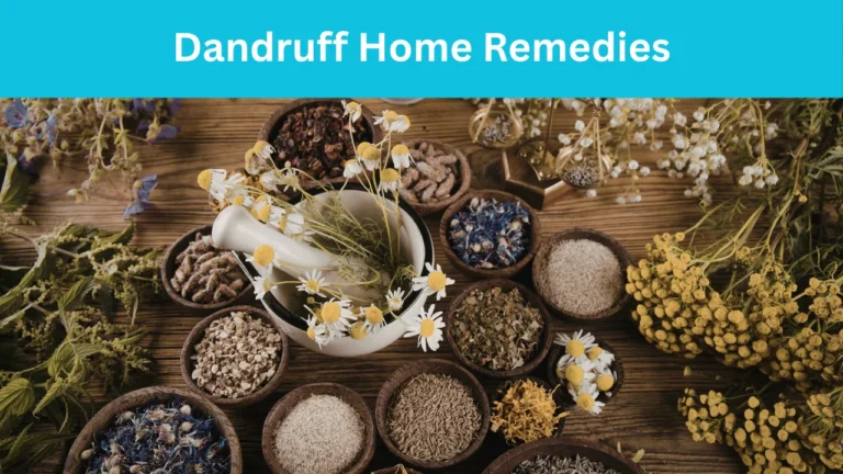 Dandruff Home Remedies